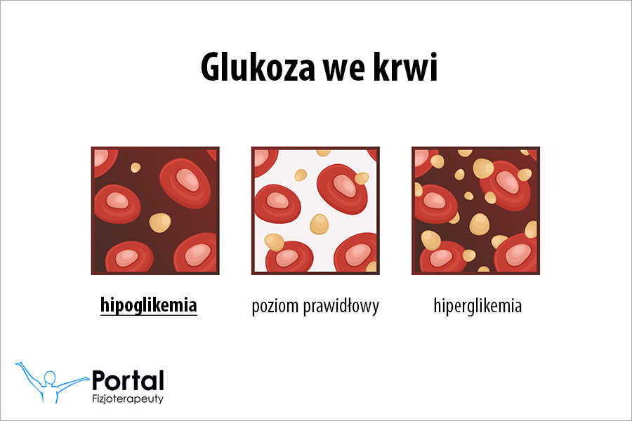 hipoglikemia hipoglikemia