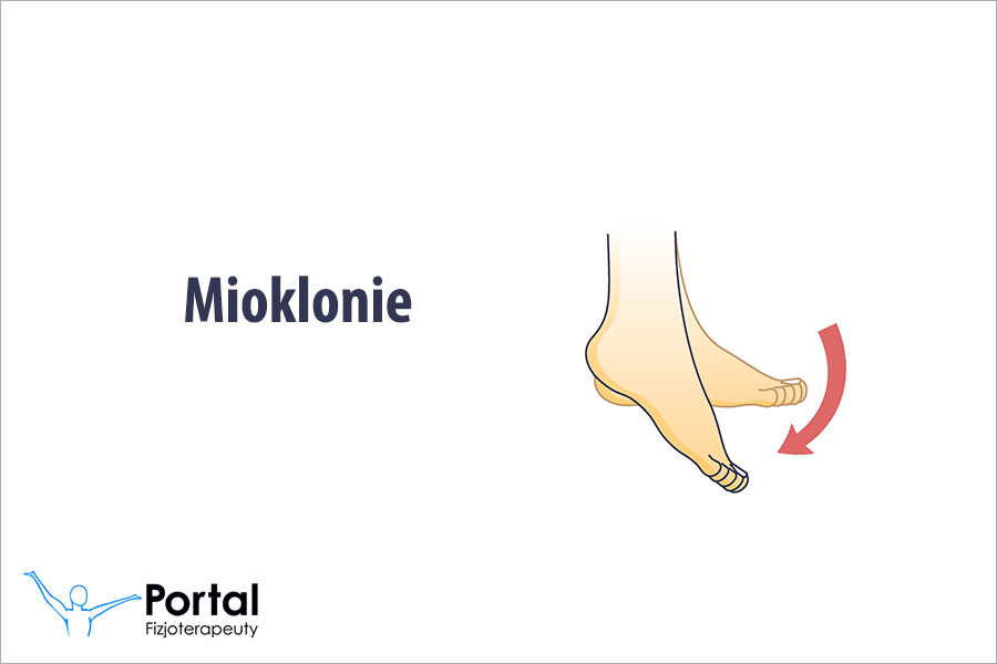 Mioklonie (inaczej: zrywy mięśniowe, ruchy mimowolne) Mioklonie (inaczej: zrywy mięśniowe, ruchy mimowolne)