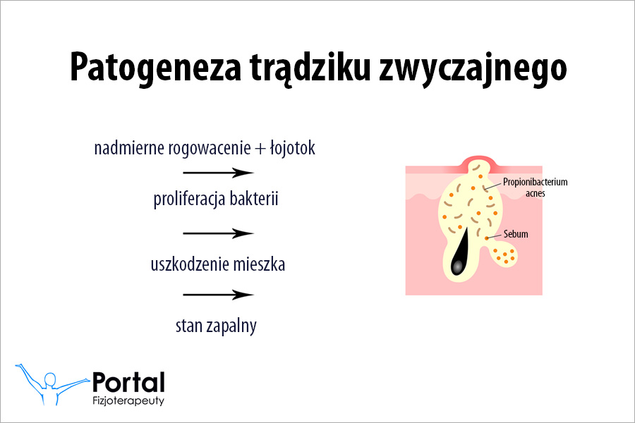 Patogeneza Patogeneza