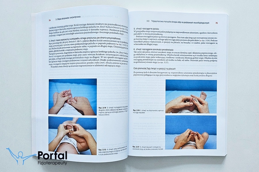 Trójpłaszczyznowa manualna terapia wad stóp u dzieci