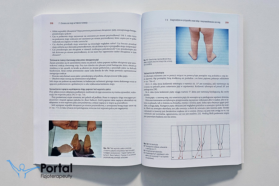 Trójpłaszczyznowa manualna terapia wad stóp u dzieci