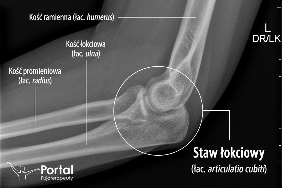 Staw łokciowy (łac. articulatio cubiti)