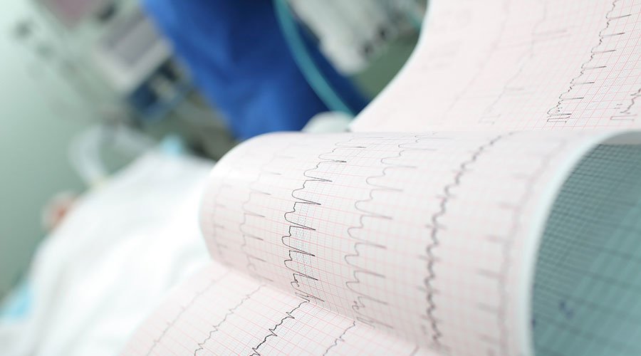 Trzepotanie przedsionków