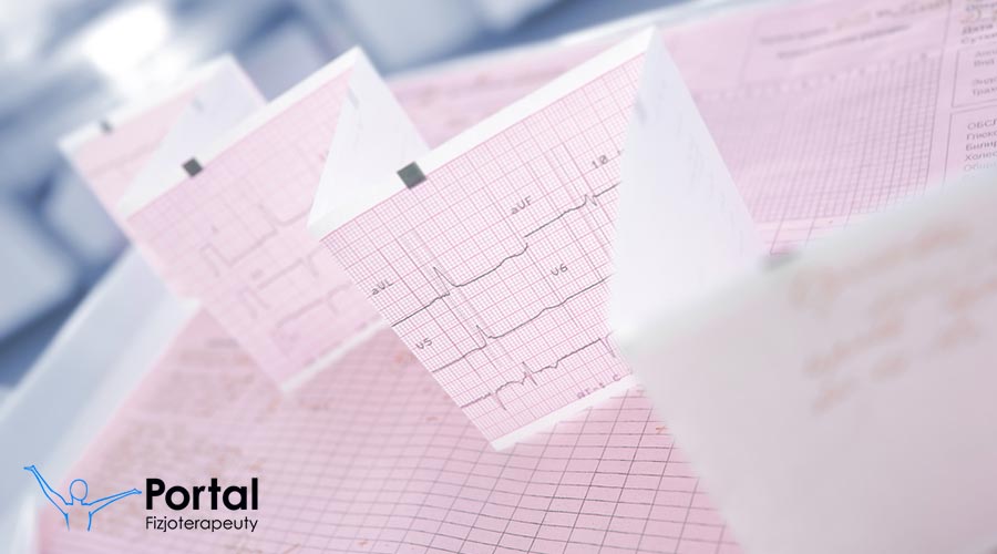 Zaburzenia przewodzenia śródkomorowe