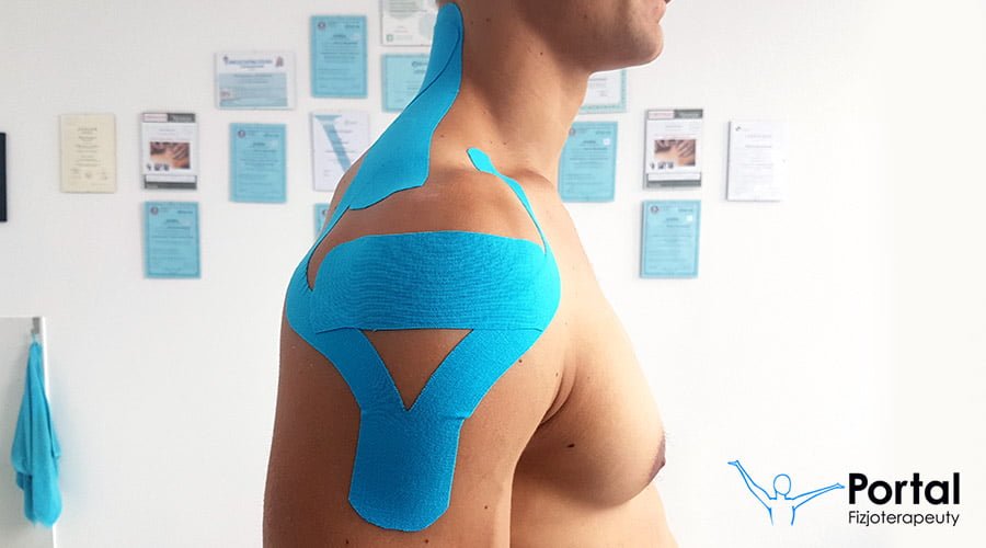 Wskazania do stosowania Kinesiology Tapingu