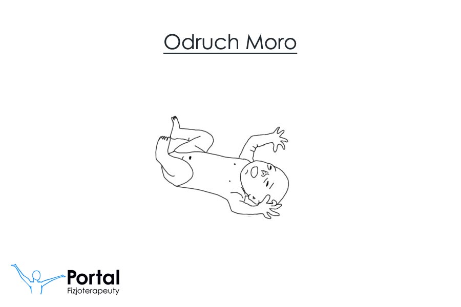 Odruch Moro