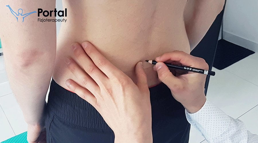 Test Schobera (objaw Schobera)