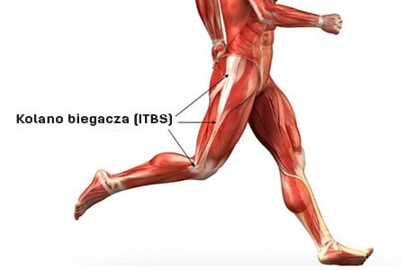 Kolano biegacza ITBS