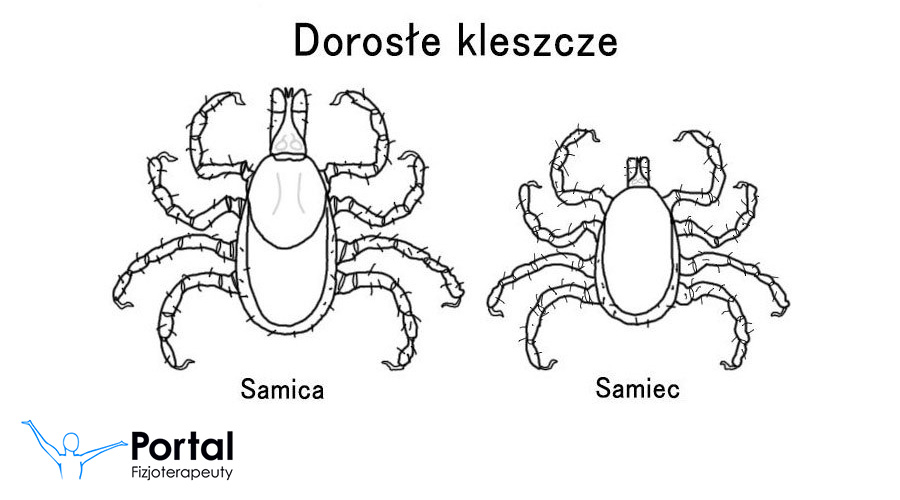 Borelioza - przyczyny, objawy, leczenie