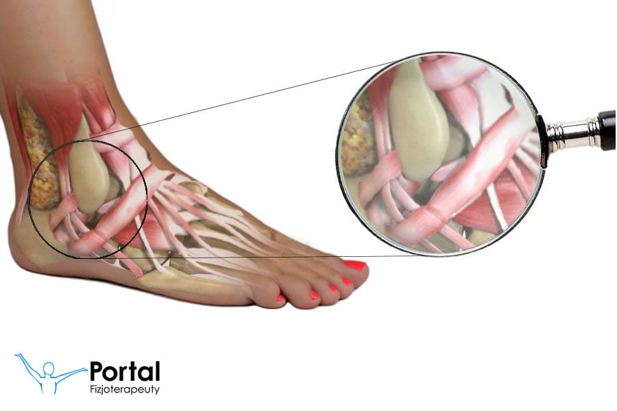 Staw skokowy - anatomia