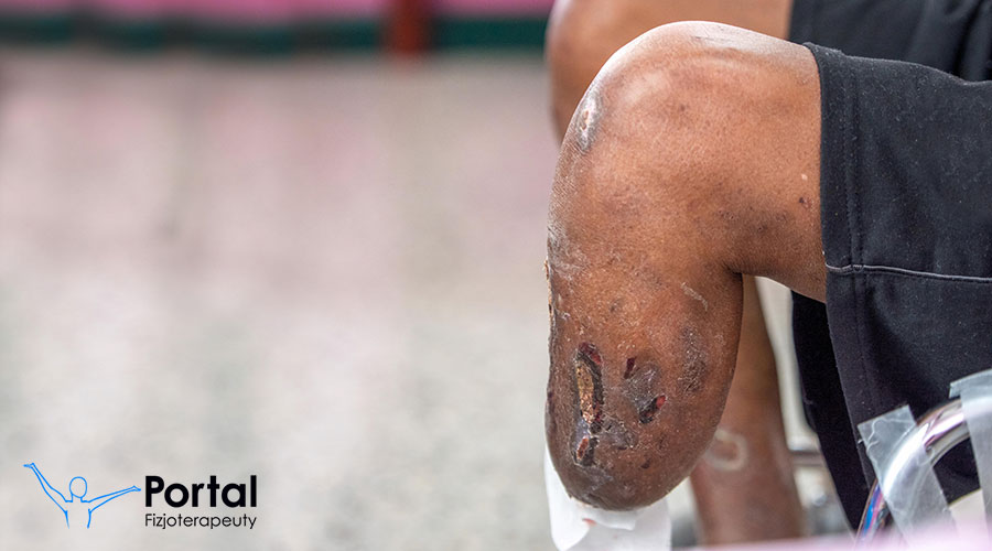 Wady i choroby kikutów