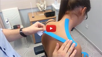 Kinesiotaping Taping mięśnia czworobocznego