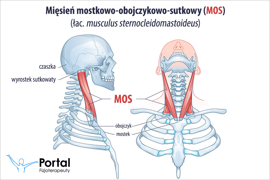 Mięsień mostkowo-obojczykowo-sutkowy (MOS)