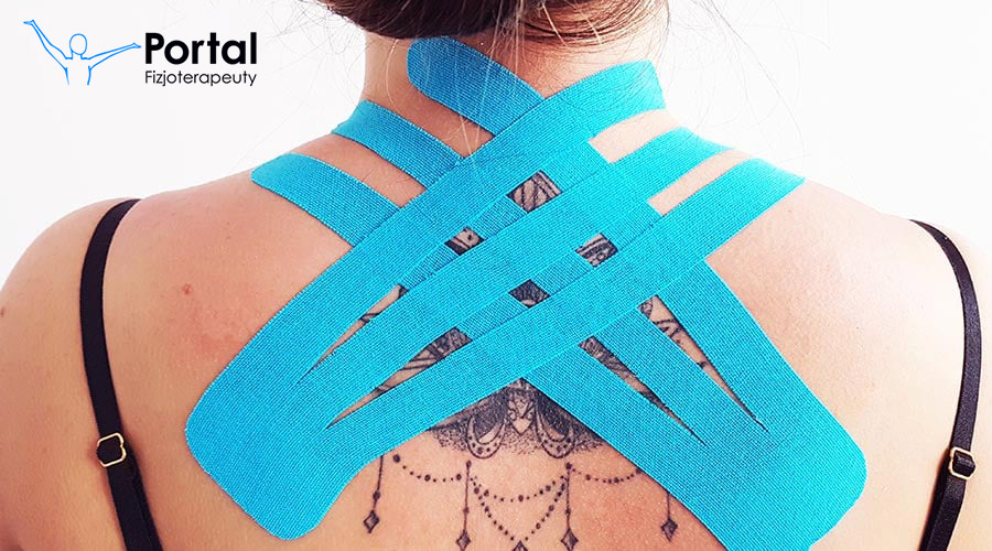 Kinesiotaping – co to jest, dla kogo i po co?