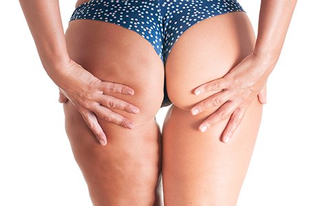 masaz prozniowy sposob na cellulit