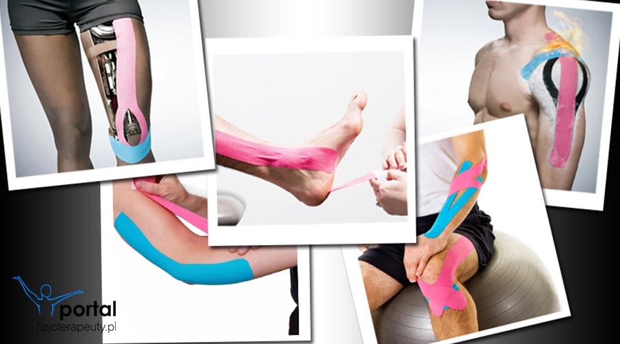 Kinesiotaping – metoda na urazy
