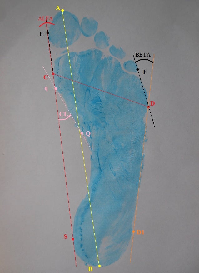 Plantokonturografia (stopa)