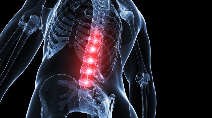 Zapalenie rdzenia kręgowego fizjoterapia