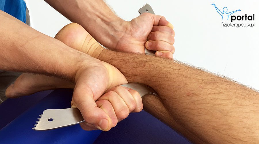 Kierowana adaptacja tkankowa