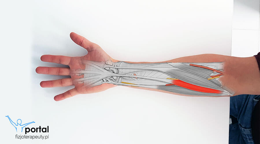 Mięsień dłoniowy długi