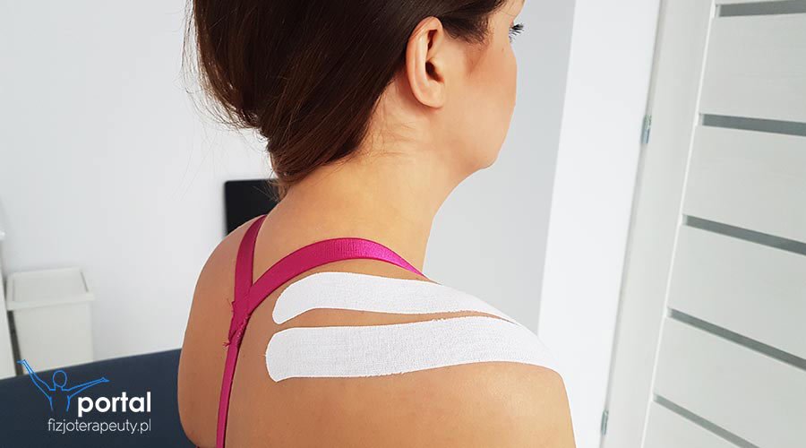 Taping mięśnia nadgrzebieniowego