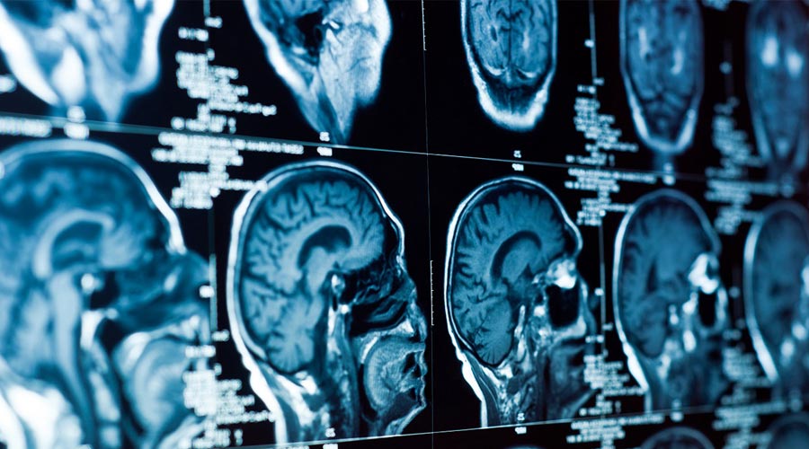 Testy neurologiczne w badaniu przedmiotowym