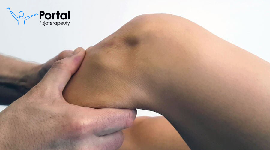 Niestabilność kolana w urazach