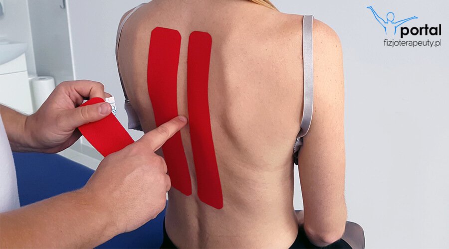 Kinesiotaping na ból pleców