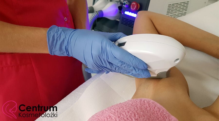 Fotodepilacja - trwałe usuwanie owłosienia