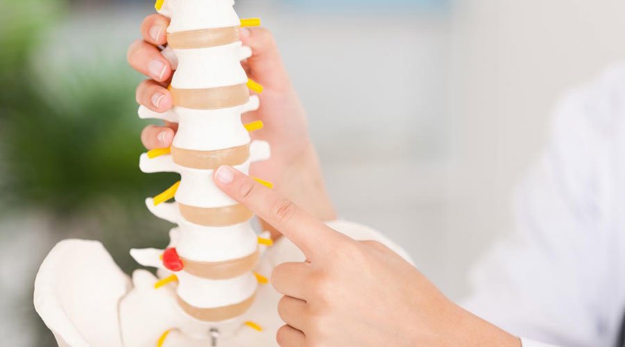 Lordoza i kifoza - co to takiego i jak to leczyć?
