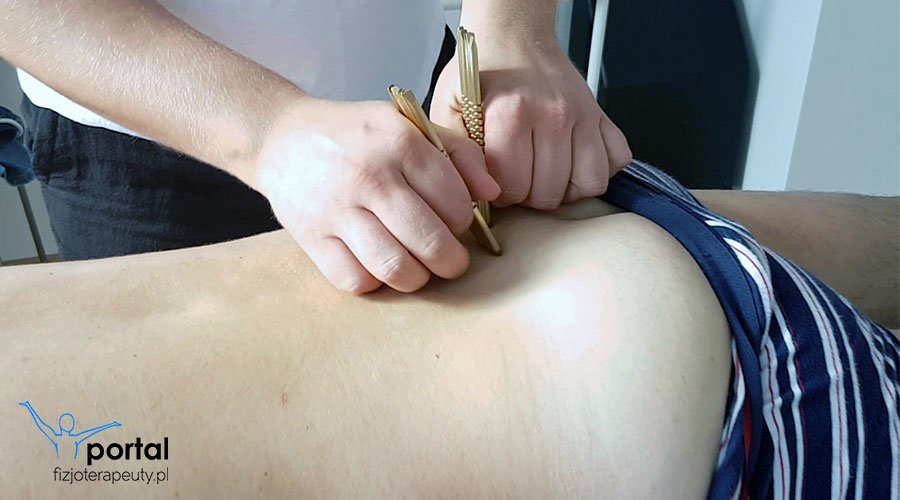 Ból kręgosłupa lędźwiowego