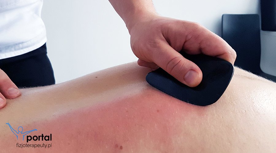 Gua-Sha - zastosowanie i działanie