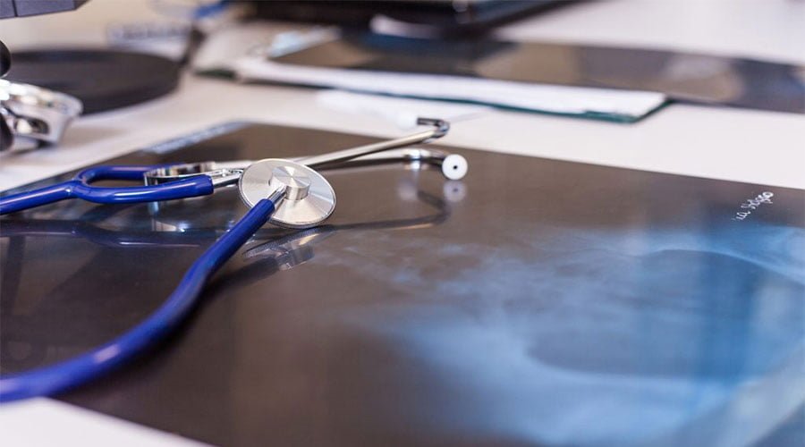 Osteoporoza - kto jest najbardziej narażony?