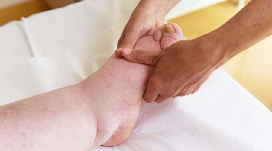 Kompleksowa terapia obrzęków