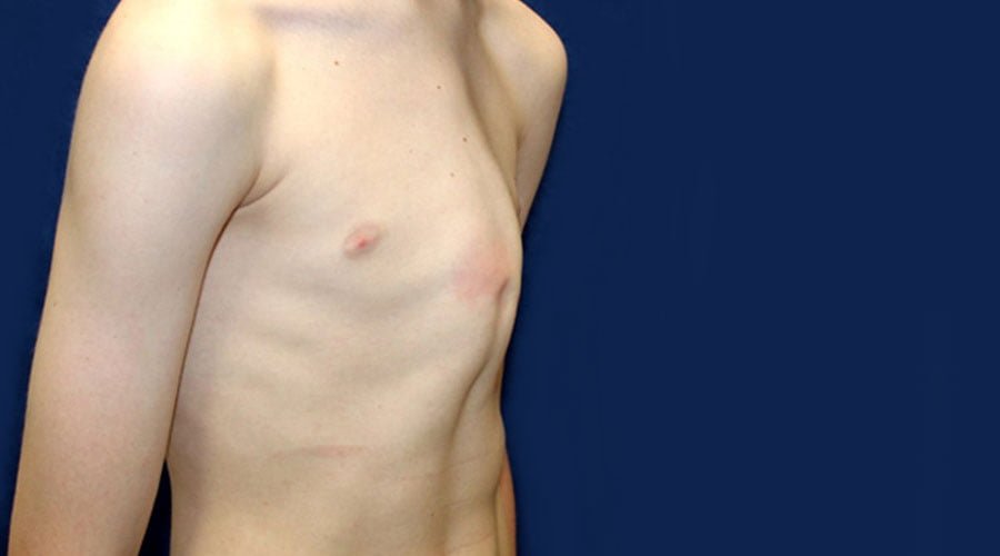 Klatka piersiowa kurza