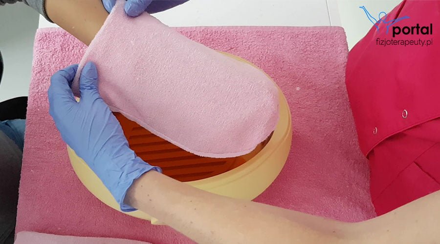 Parafinoterapia - leczenie parafiną