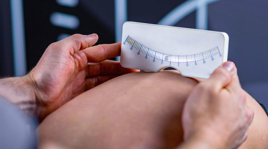 Masaż przy skoliozie