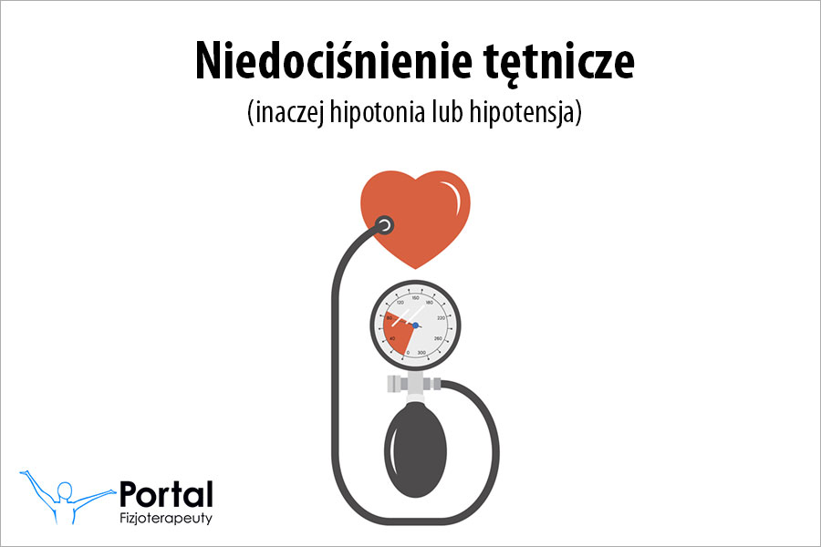 Niedociśnienie tętnicze