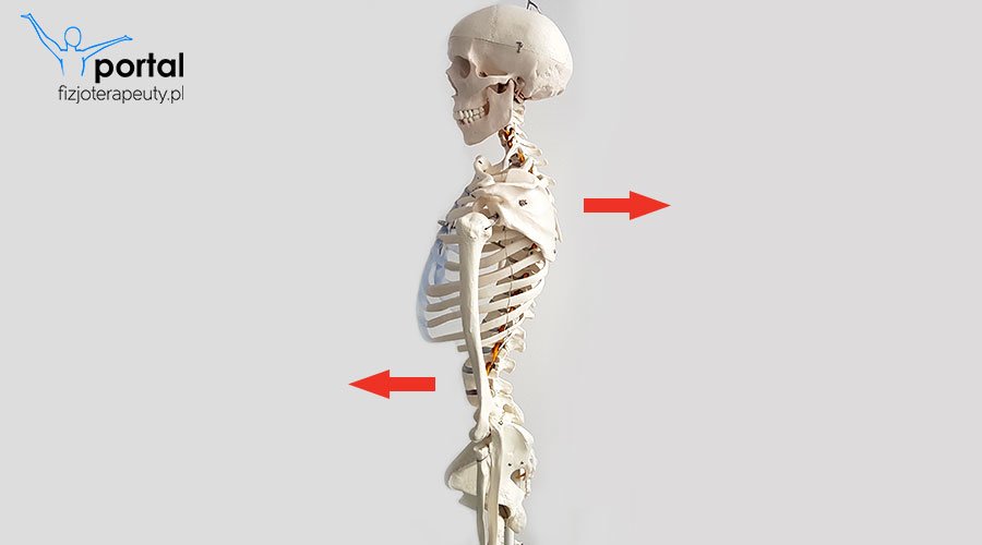 Plecy okrągło-wklęsłe - fizjoterapia