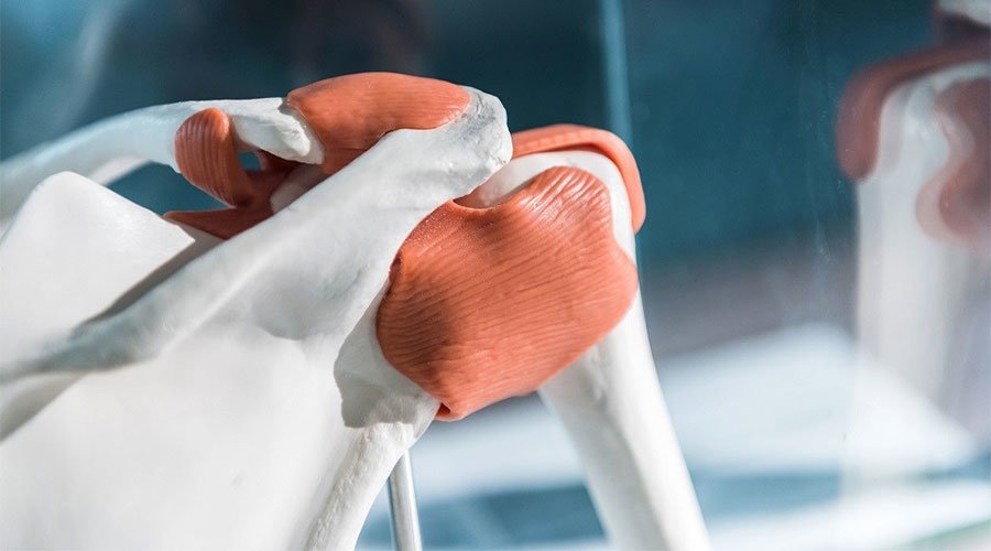 Alloplastyka stawu ramiennego