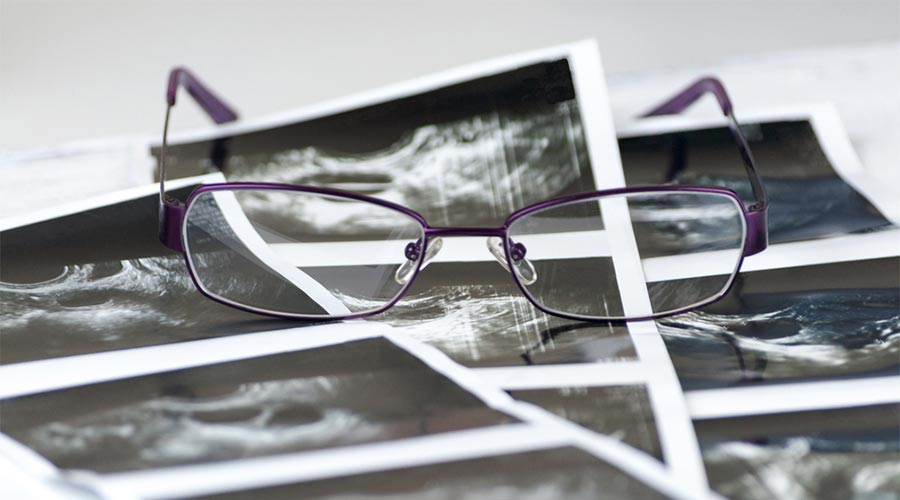 Leczenie niepłodności u kobiet