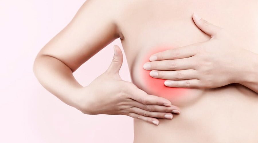 Połogowe zapalenie gruczołu sutkowego