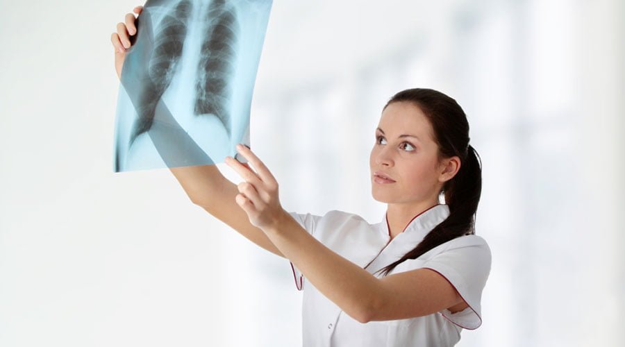 Wysiękowe zapalenie opłucnej fizjoterapia