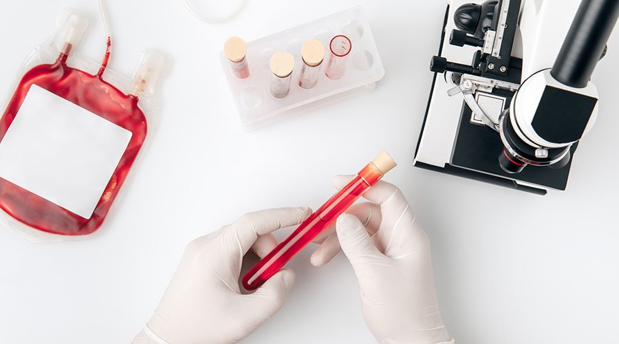 Krew - skład, elementy morfotyczne, funkcje