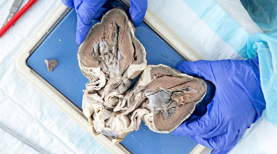 Serce - budowa, funkcje