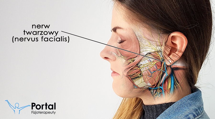 Porażenie nerwu twarzowego