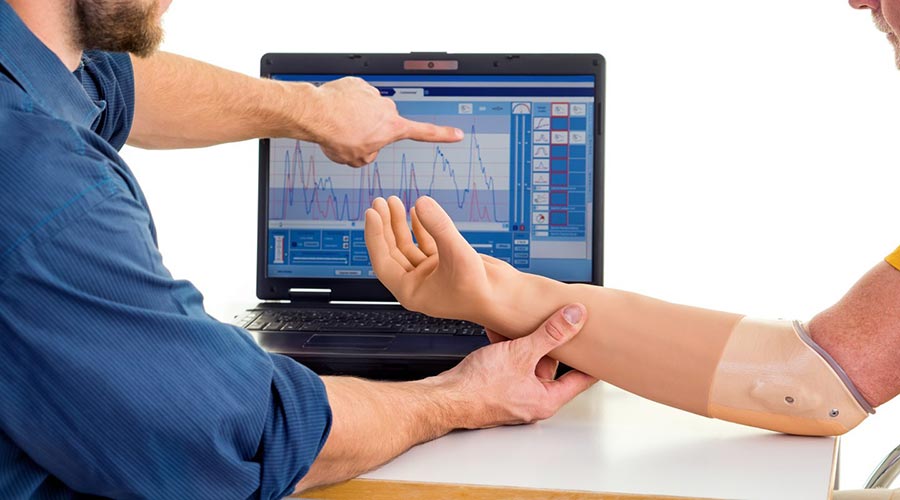 Rehabilitacja po amputacji kończyny górnej