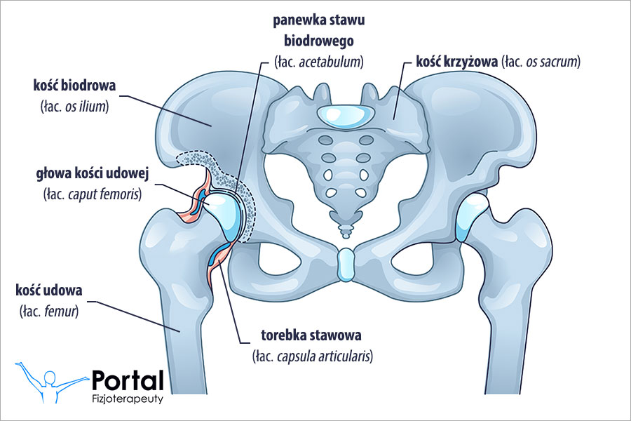 Konflikt panewkowo-udowy (FAI)