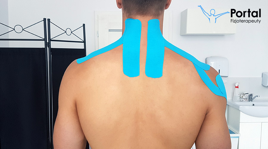 Techniki kinesiotapingu