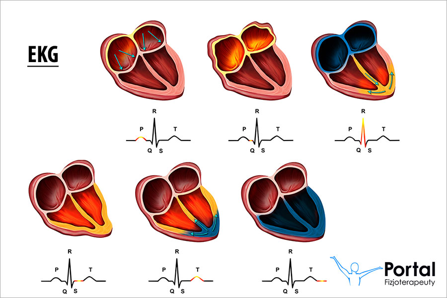 EKG (elektrokardiografia)